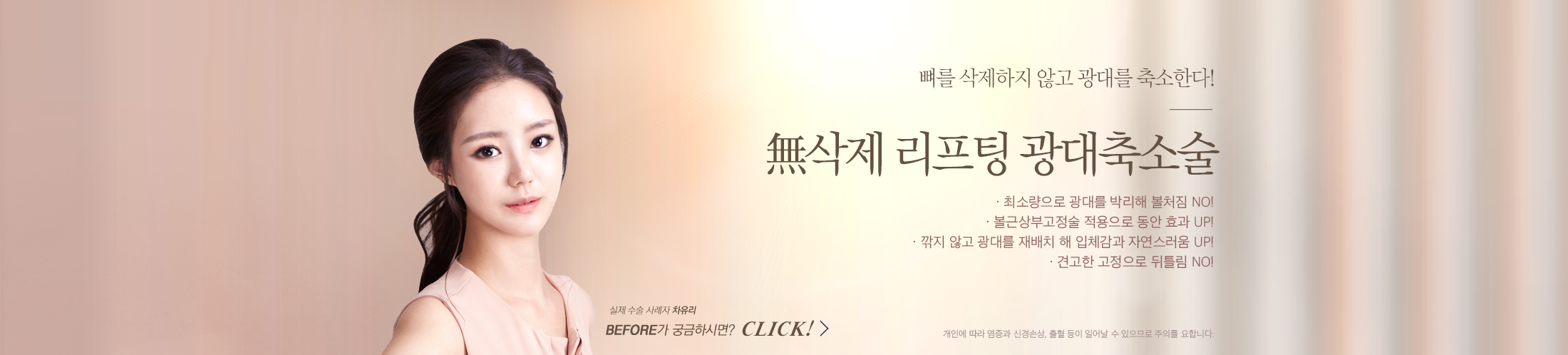 Cheekbone Reduction Surgery