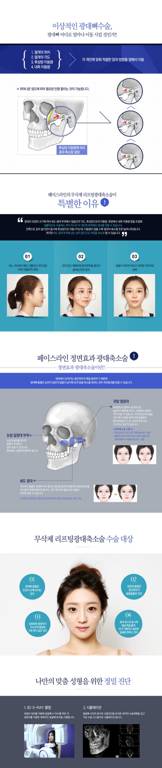 Cheekbone Reduction Results