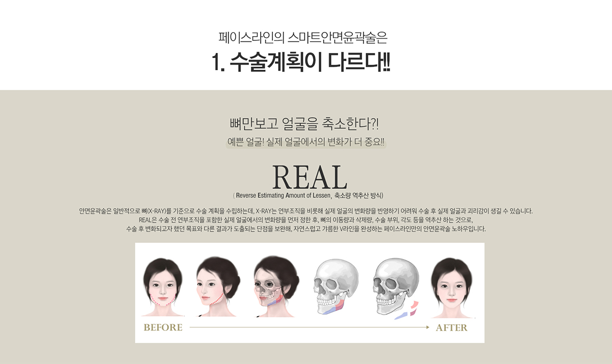 Facial Contouring Method