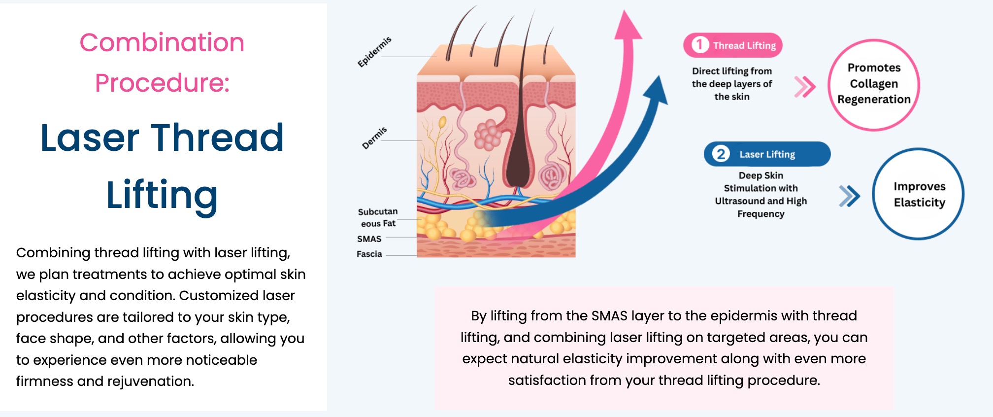 Kombinasi Tanam Benang + Laser Lifting