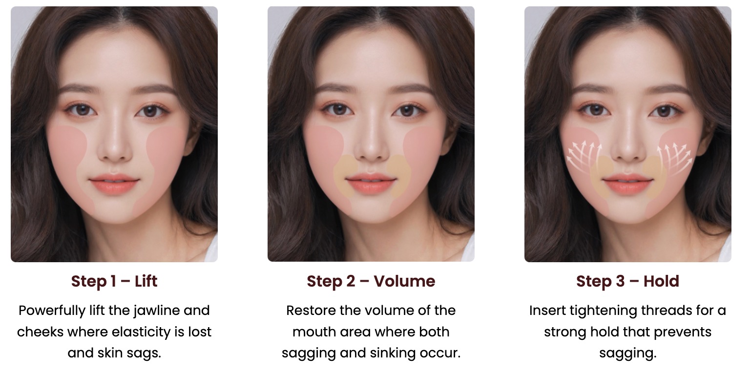 Tanam Benang 3 Langkah: Angkat → Volume → Tahan