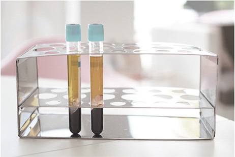 Cell separation