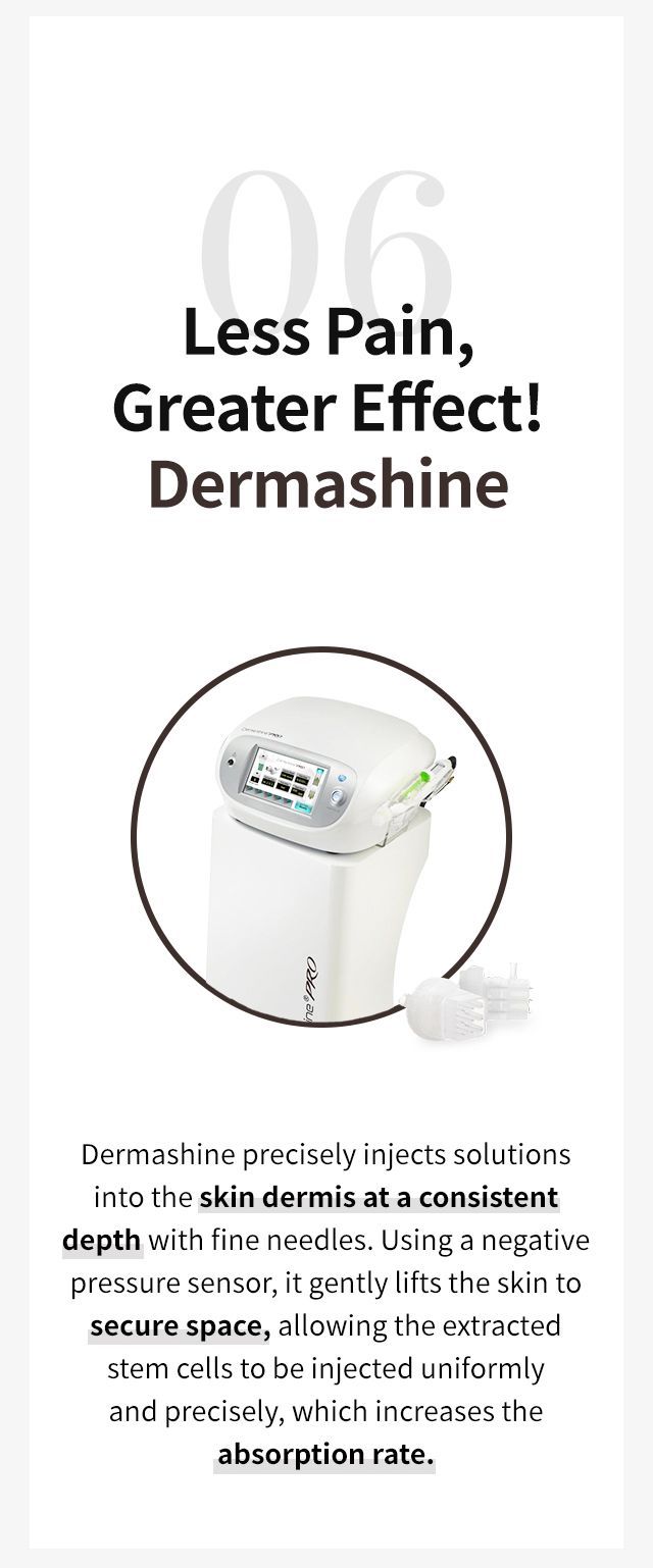 Injection device
