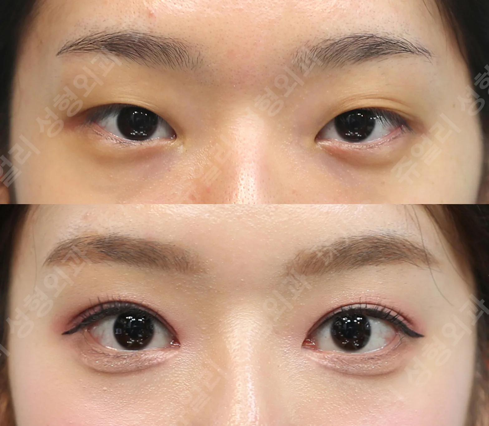 Jewelry Plastic Surgery Before-and-after cases 1