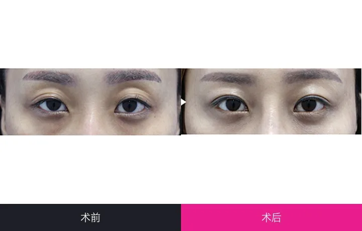 CLASSY Plastic Surgery Before-and-after cases 2