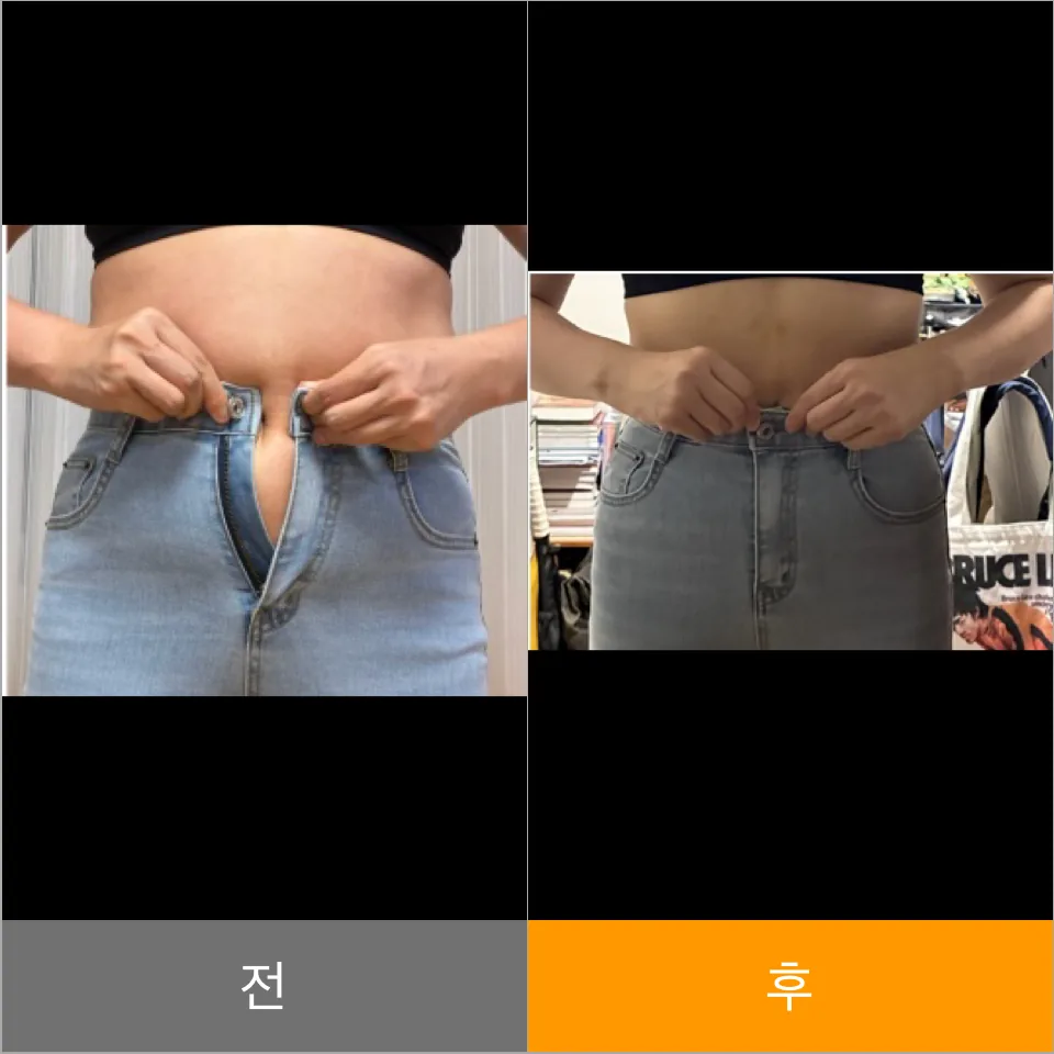 韩国365mc腰腹塑形匿名对比案例