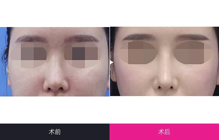 CLASSY Plastic Surgery Before-and-after cases 5