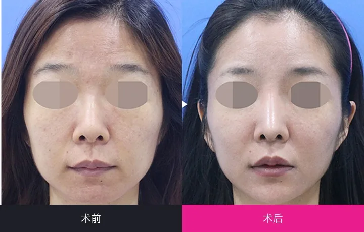 CLASSY Plastic Surgery Before-and-after cases 8