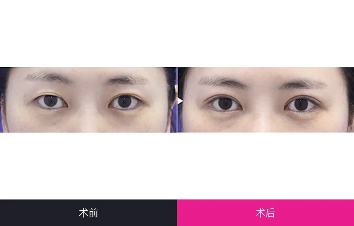 CLASSY Plastic Surgery Before-and-after cases 3