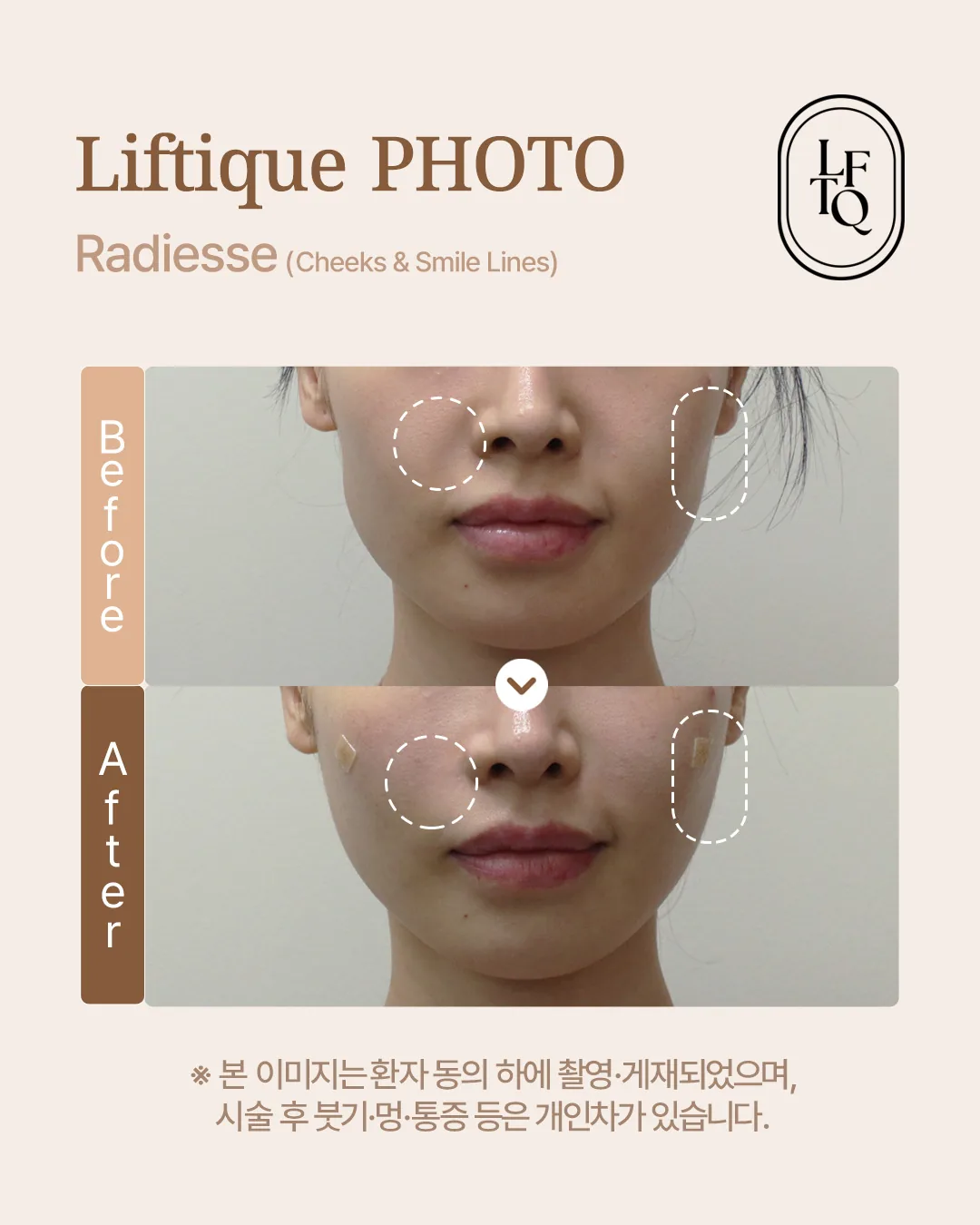 공식 사례 5
