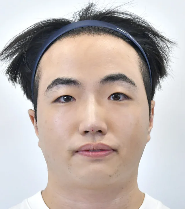 Ca điều trị chính thức 6
