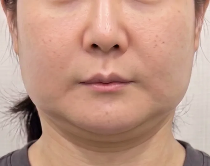 JN 美容外科