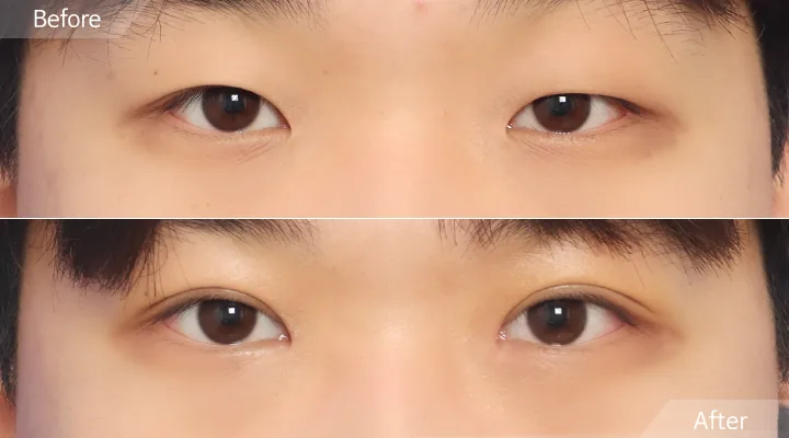 Official before-and-after cases 15