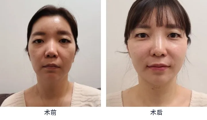 Official before-and-after cases 3