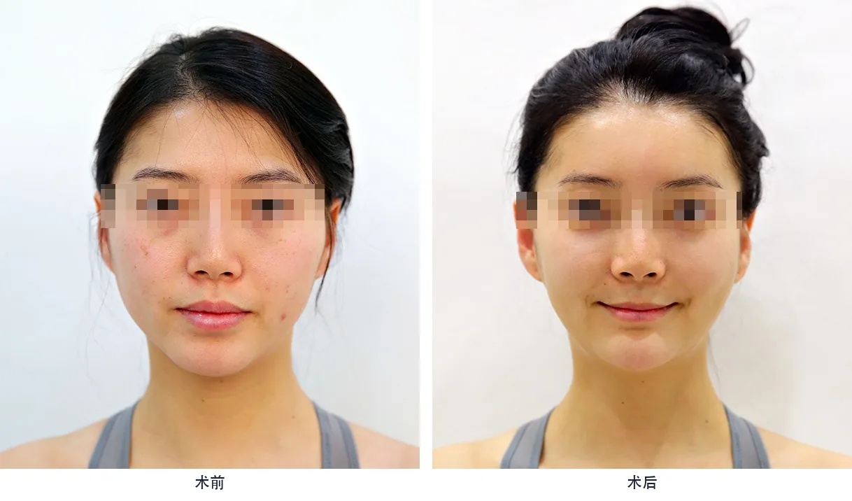Official before-and-after cases 20