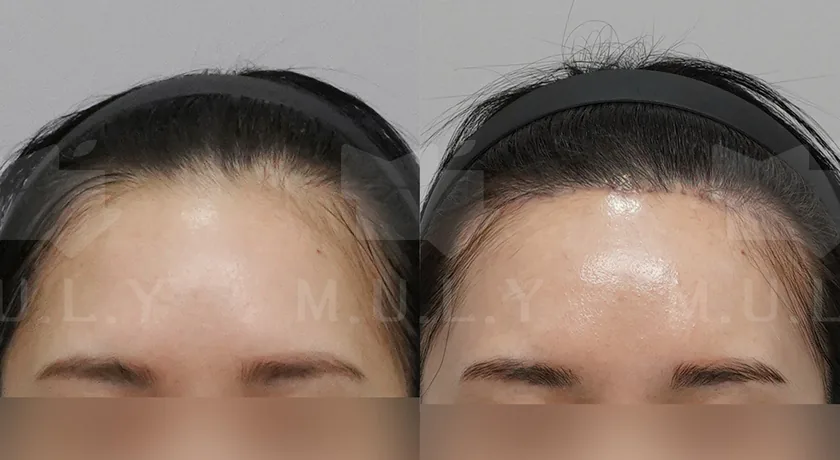 Kasus resmi 1