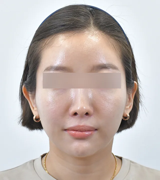 Ca điều trị chính thức 4