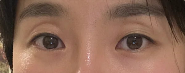 公式症例 25