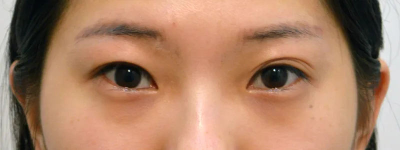 VOLUME 美容外科