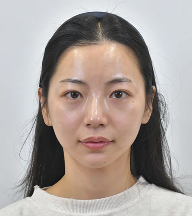 Ca điều trị chính thức 9