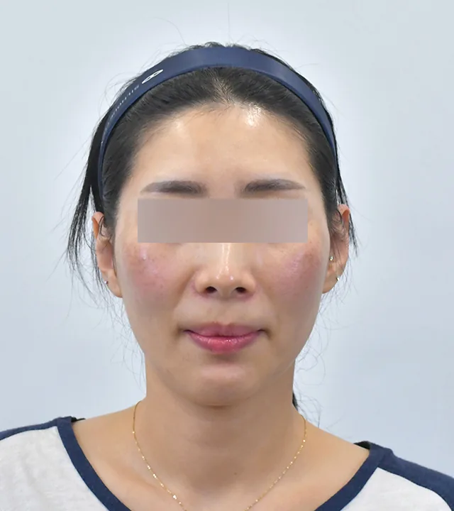 Ca điều trị chính thức 15