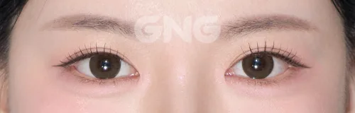 공식 사례 17
