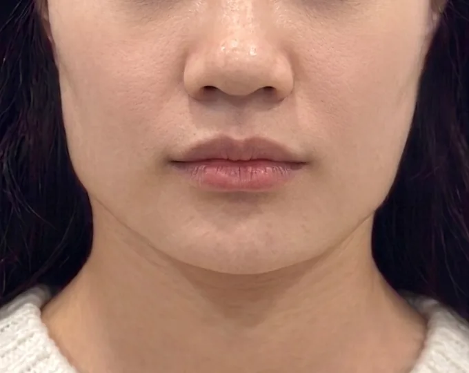 JN 美容外科