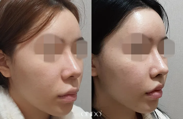 ONDO Plastic Surgery
