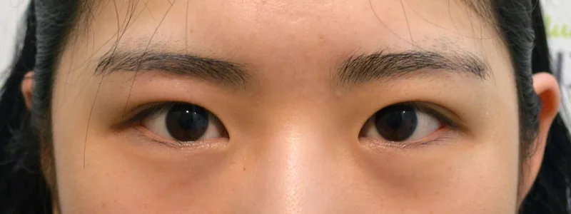 VOLUME 美容外科
