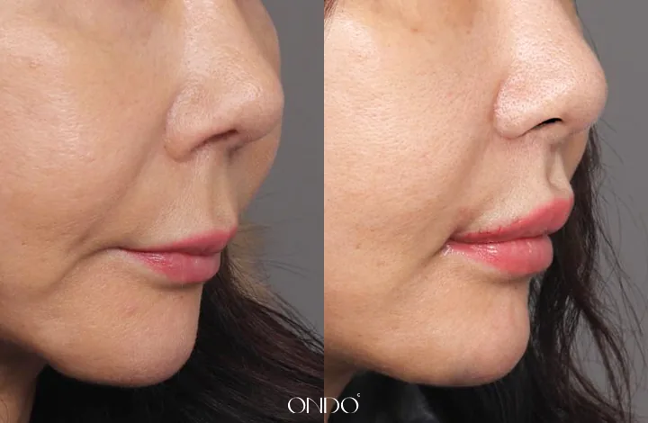 ONDO Plastic Surgery