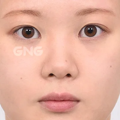 공식 사례 1