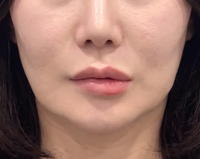 JN 美容外科