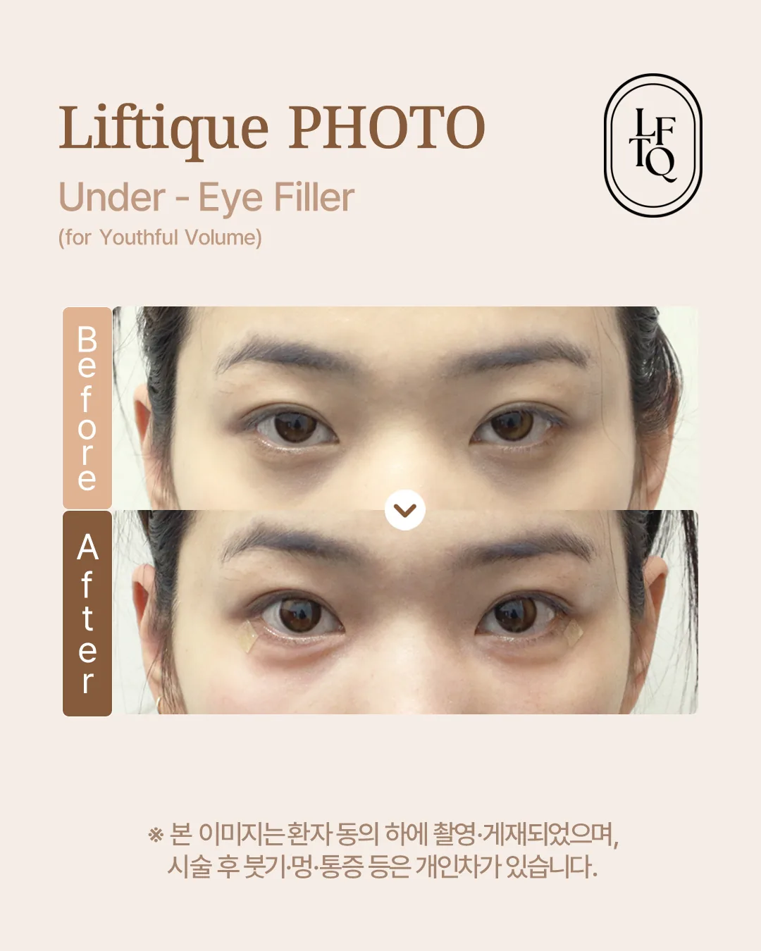 공식 사례 6