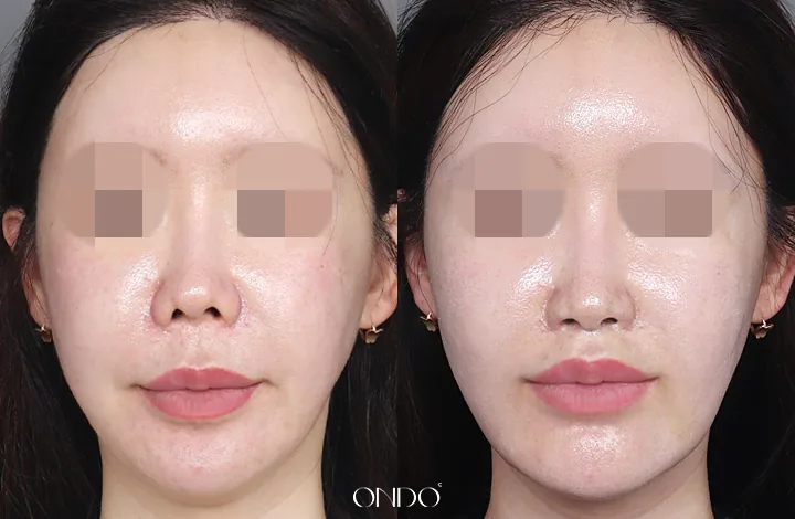 ONDO Plastic Surgery