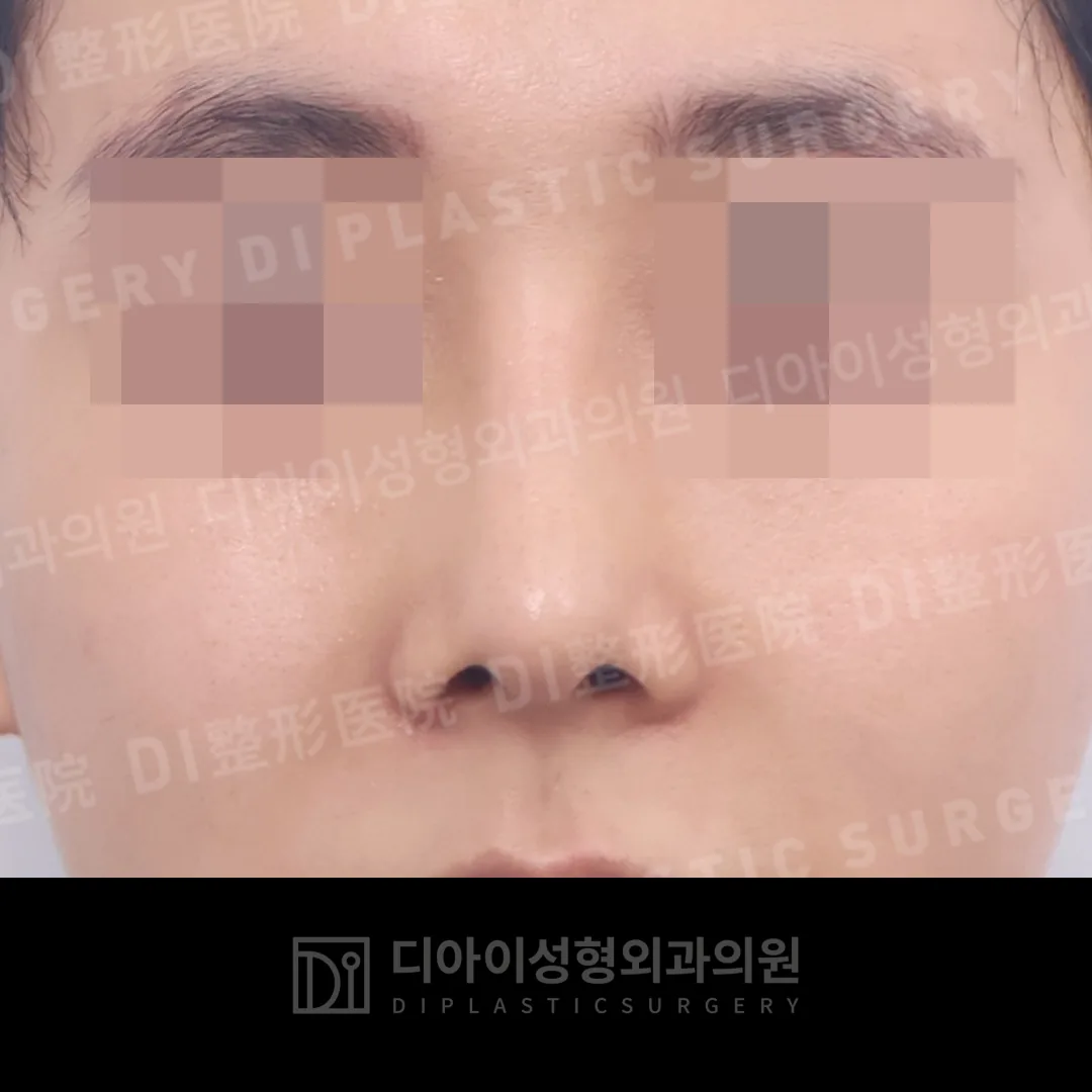 DI คลินิกศัลยกรรม