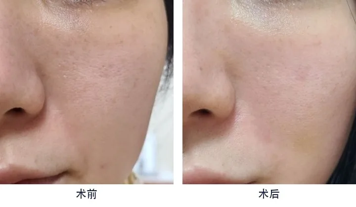 Official before-and-after cases 2