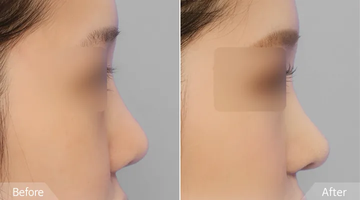 Official before-and-after cases 5