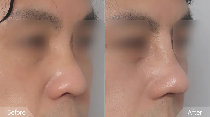 Official before-and-after cases 7