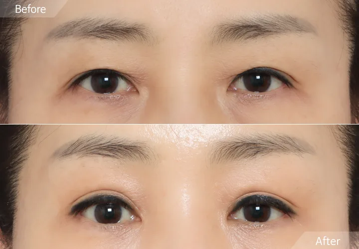 Official before-and-after cases 12