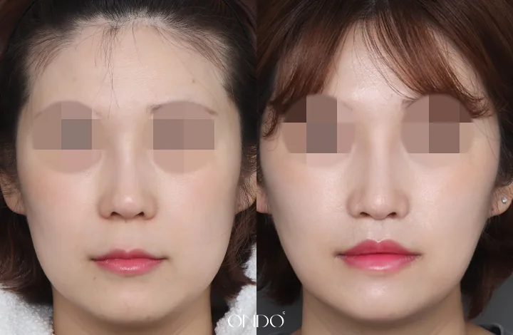 ONDO Plastic Surgery