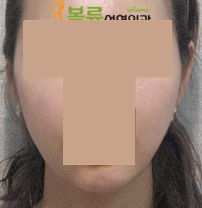 VOLUME 美容外科