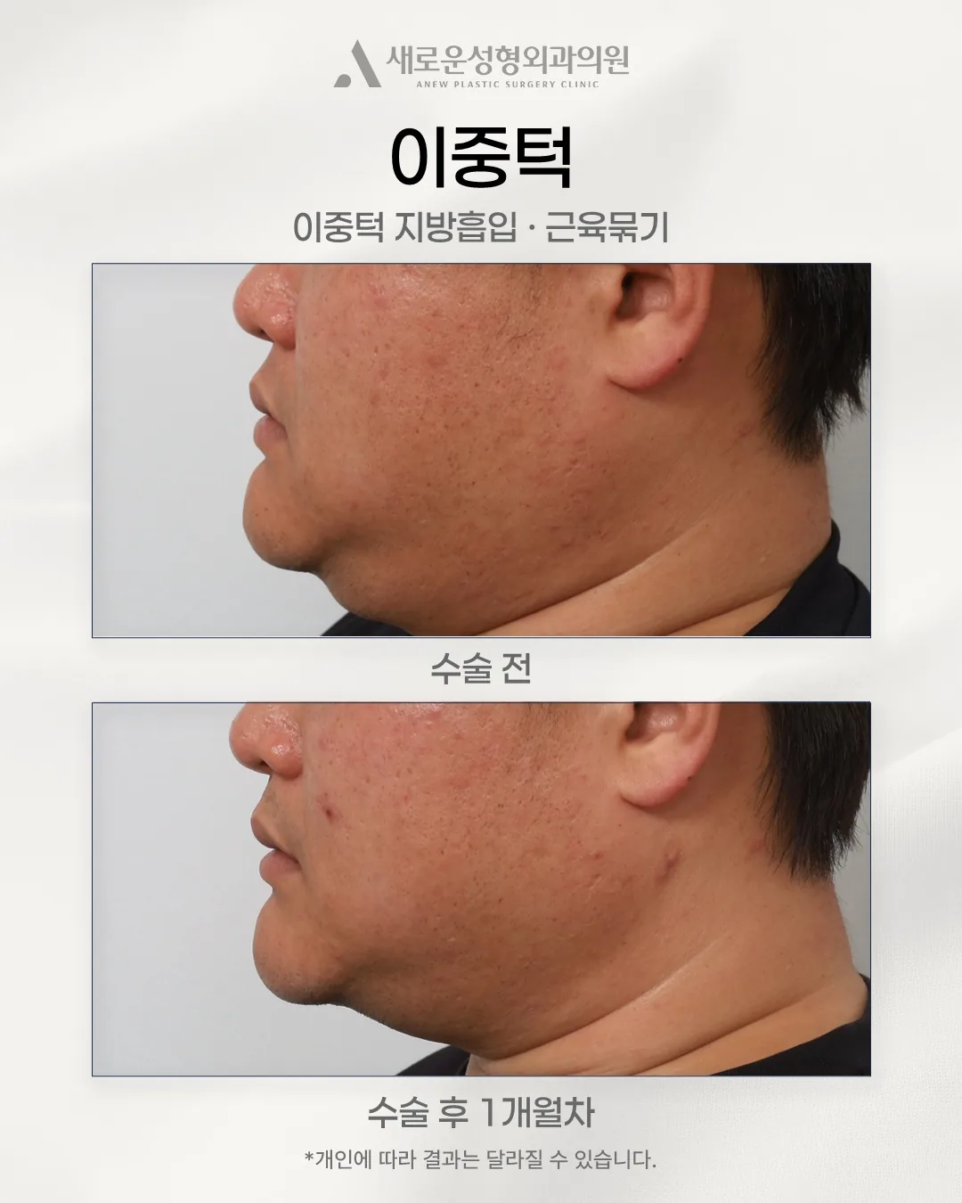 신의선성형외과의원