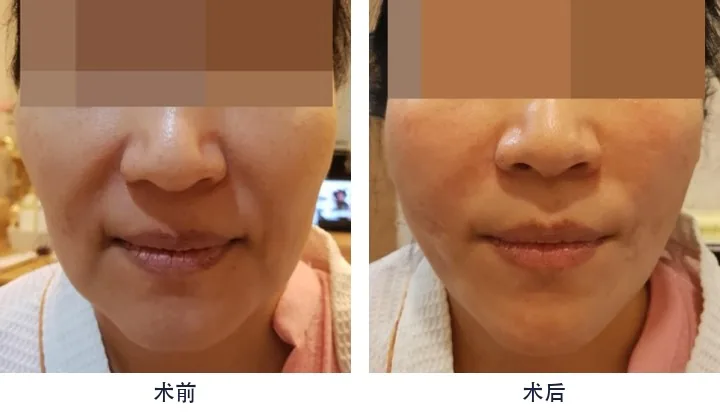 Official before-and-after cases 12