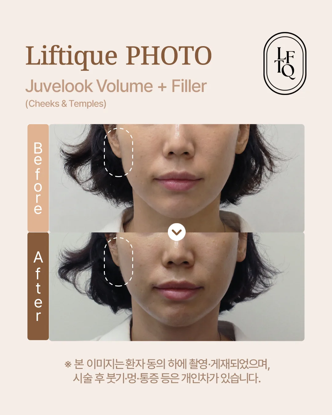 공식 사례 4