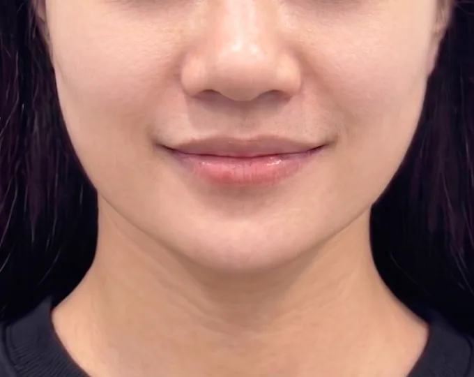 JN 美容外科