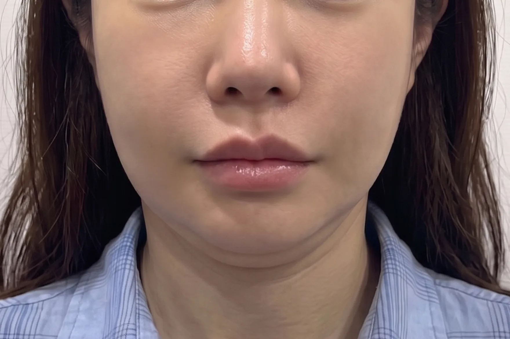 JN 美容外科
