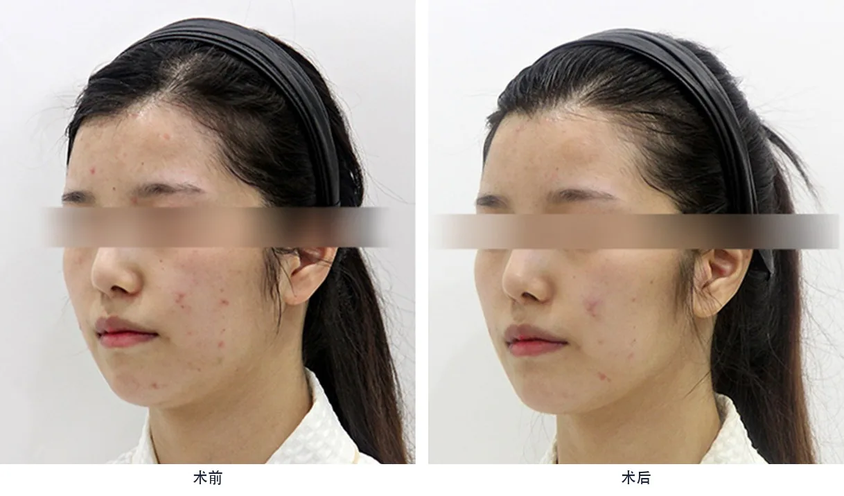 Official before-and-after cases 13