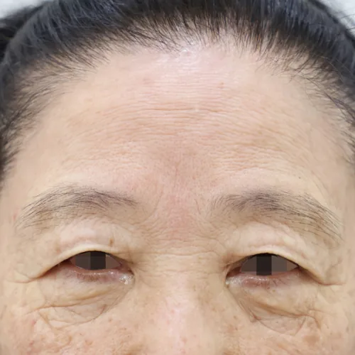 병원 공개 사례 이미지