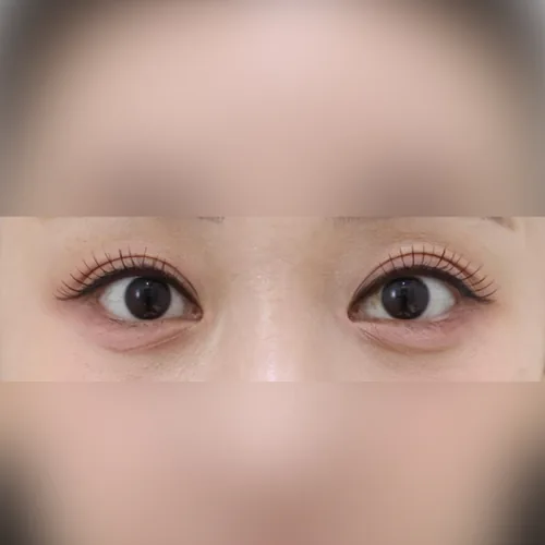 병원 공개 사례 이미지