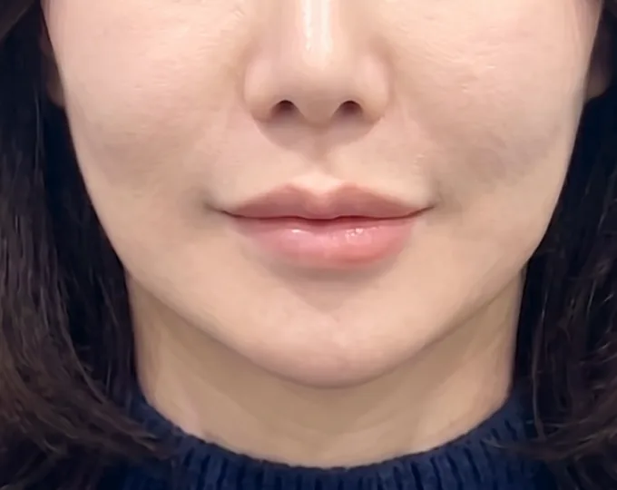 JN 美容外科